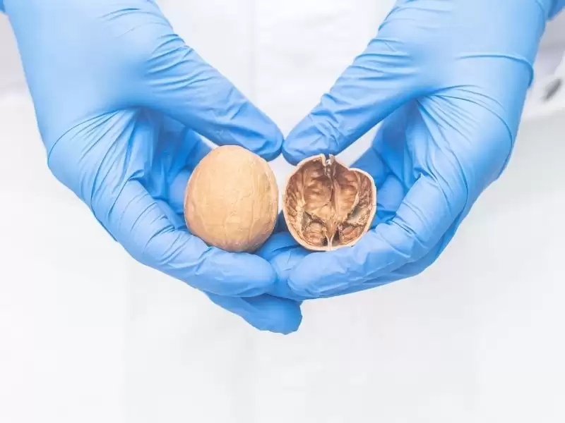 testis-kanseri-evreleri