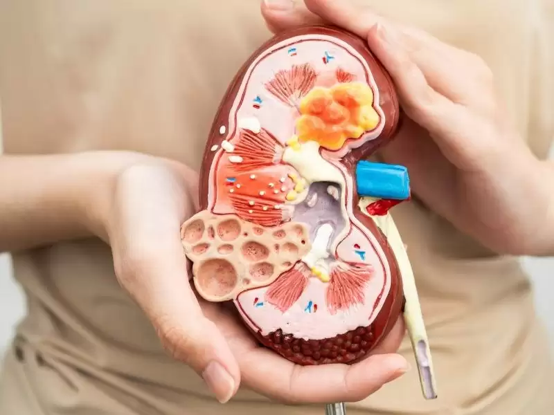 bobrek-tasindan-kurtulmanin-yollari