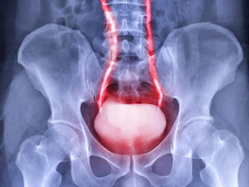 mesanenin-tam-bosalmamasi-hissi-neden-olusur